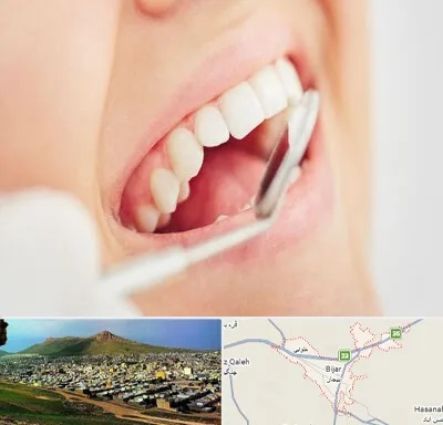 اصلاح طرح لبخند در بیجار