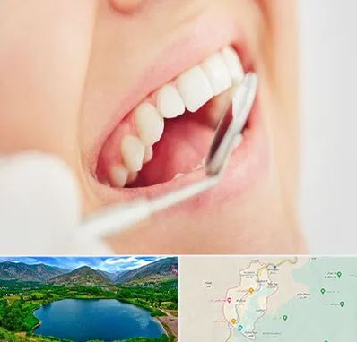 اصلاح طرح لبخند در رودبار