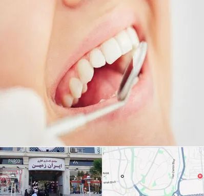 اصلاح طرح لبخند در ایران زمین