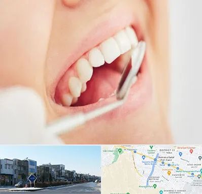 اصلاح طرح لبخند در شریعتی مشهد