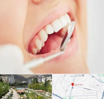 اصلاح طرح لبخند در بلوار تعاون