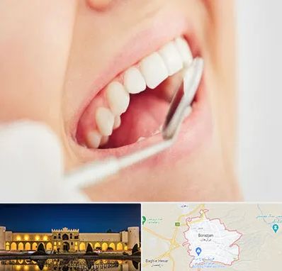 اصلاح طرح لبخند در برازجان