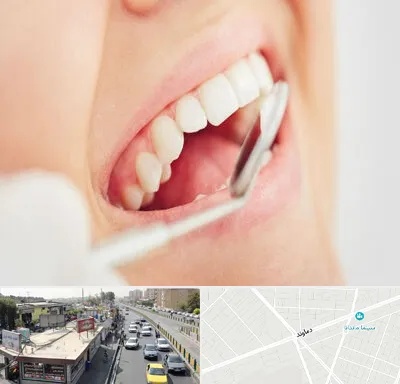 اصلاح طرح لبخند در خیابان دماوند