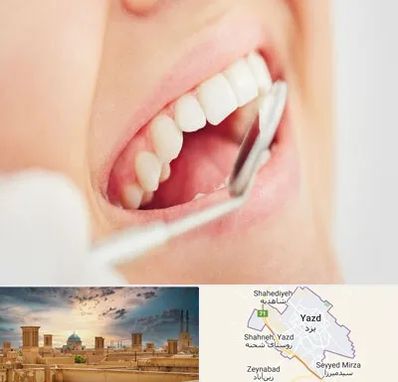 اصلاح طرح لبخند در یزد