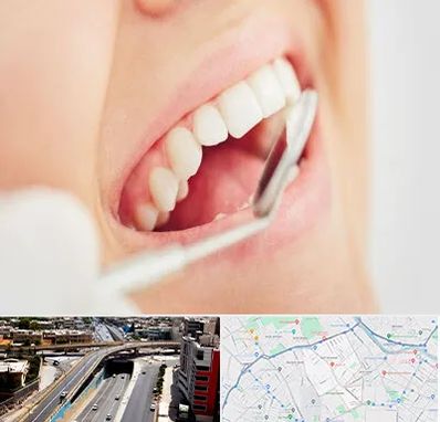 اصلاح طرح لبخند در ستارخان شیراز