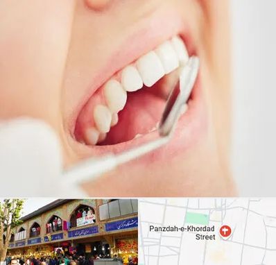 اصلاح طرح لبخند در 15 خرداد