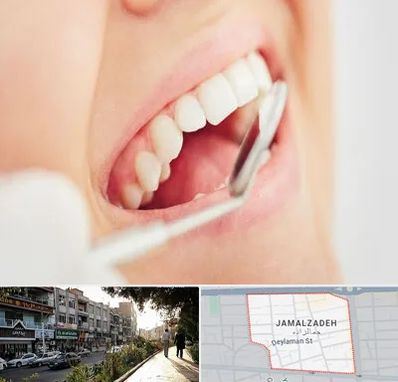 اصلاح طرح لبخند در خیابان جمالزاده