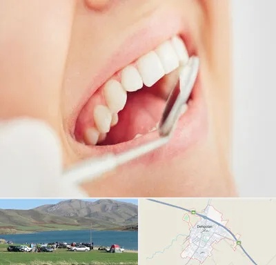 اصلاح طرح لبخند در دهگلان