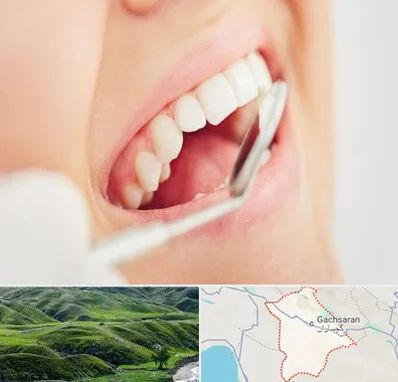 اصلاح طرح لبخند در گچساران