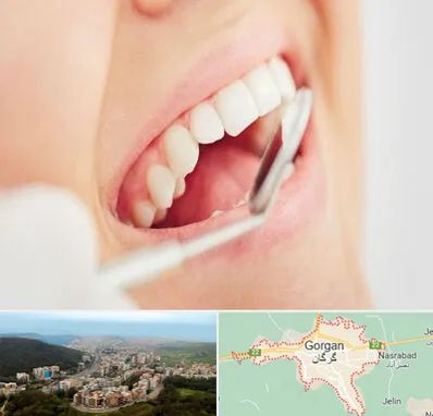 اصلاح طرح لبخند در گرگان