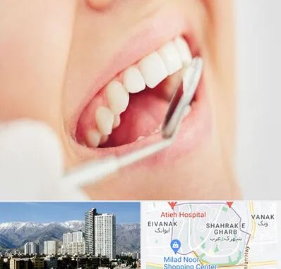 اصلاح طرح لبخند در شهرک غرب 