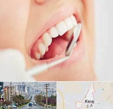 اصلاح طرح لبخند در گوهردشت کرج 