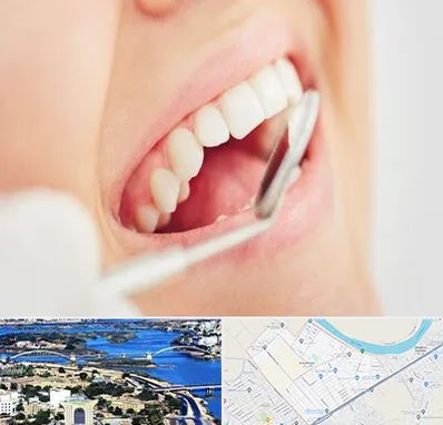 اصلاح طرح لبخند در کوروش اهواز