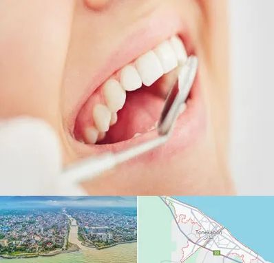 اصلاح طرح لبخند در تنکابن