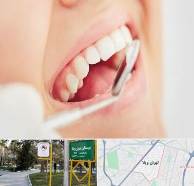 اصلاح طرح لبخند در تهران ویلا