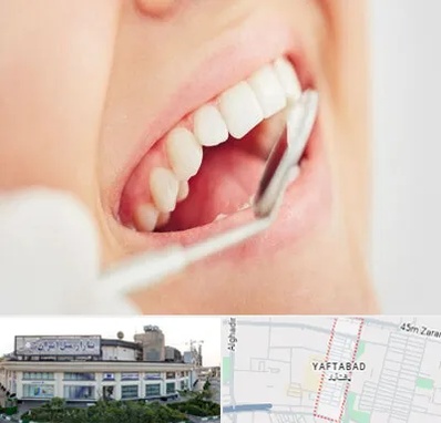 اصلاح طرح لبخند در یافت آباد