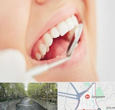 اصلاح طرح لبخند در زرگنده