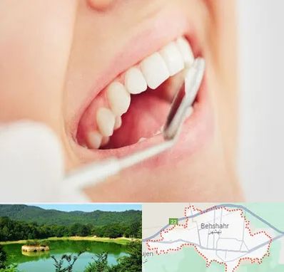 اصلاح طرح لبخند در بهشهر