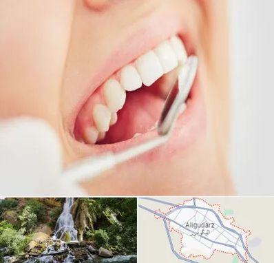 اصلاح طرح لبخند در الیگودرز