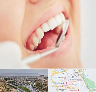 اصلاح طرح لبخند در معالی آباد شیراز