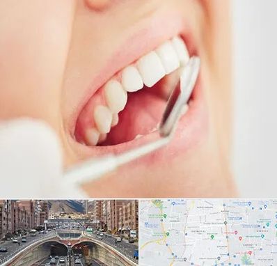 اصلاح طرح لبخند در منطقه 10 تهران