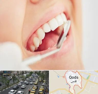 اصلاح طرح لبخند در شهر قدس