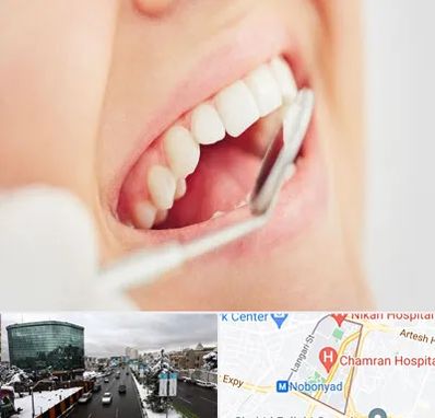 اصلاح طرح لبخند در اقدسیه 