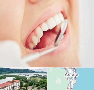 اصلاح طرح لبخند در آستارا