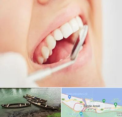 اصلاح طرح لبخند در بندر انزلی