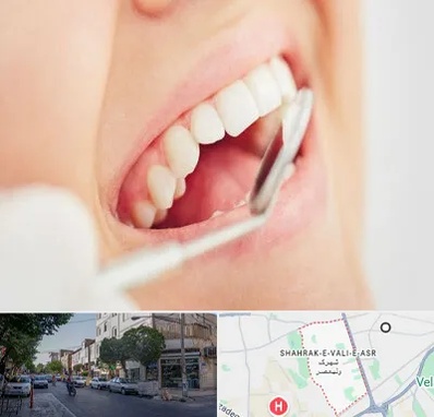 اصلاح طرح لبخند در شهرک ولیعصر