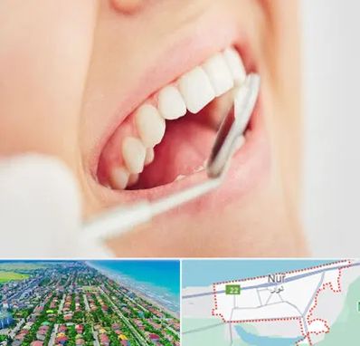 اصلاح طرح لبخند در نور