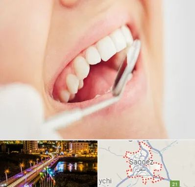 اصلاح طرح لبخند در سقز