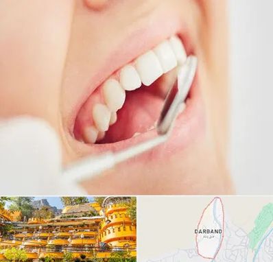 اصلاح طرح لبخند در دربند