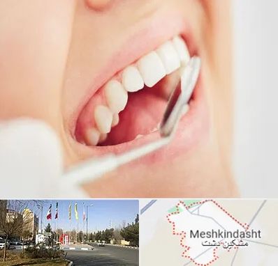 اصلاح طرح لبخند در مشکین دشت