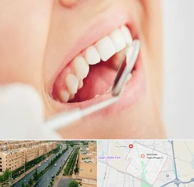 اصلاح طرح لبخند در فاز سه اندیشه