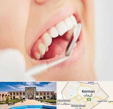 اصلاح طرح لبخند در کرمان