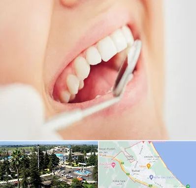 اصلاح طرح لبخند در رودسر