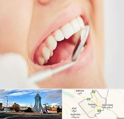 اصلاح طرح لبخند در تایباد