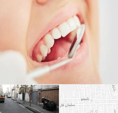 اصلاح طرح لبخند در خیابان نامجو