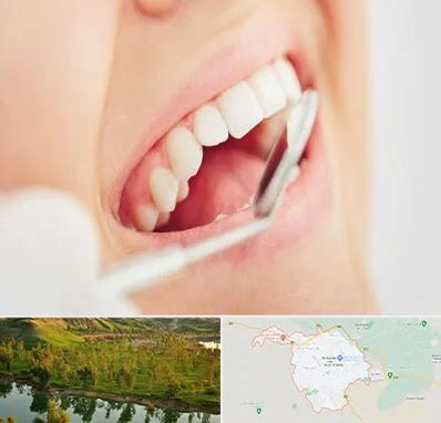 اصلاح طرح لبخند در بهبهان