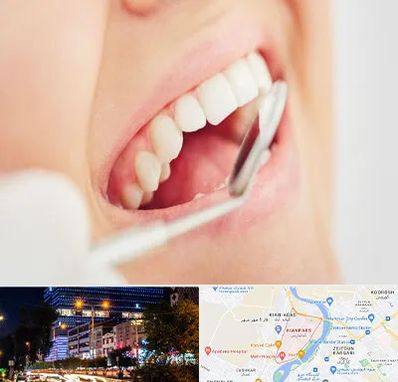 اصلاح طرح لبخند در کیانپارس اهواز