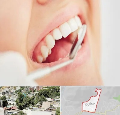 اصلاح طرح لبخند در جماران