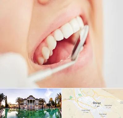 اصلاح طرح لبخند در شیراز