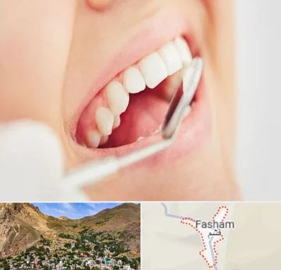 اصلاح طرح لبخند در فشم