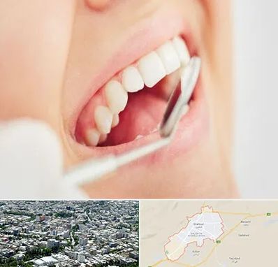 اصلاح طرح لبخند در شاهرود