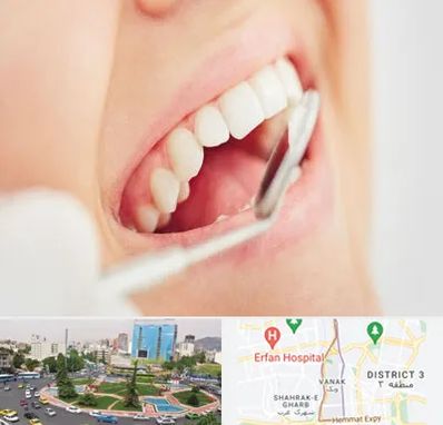 اصلاح طرح لبخند در ونک 