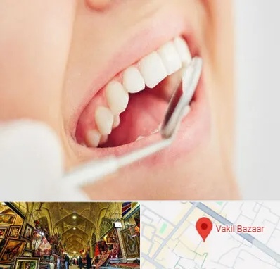 اصلاح طرح لبخند در بازار وکیل شیراز