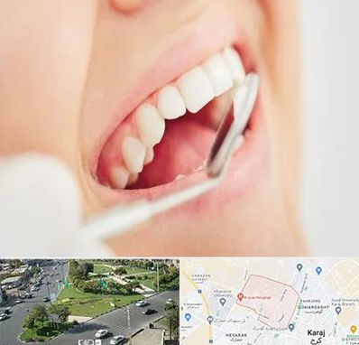 اصلاح طرح لبخند در شاهین ویلا کرج