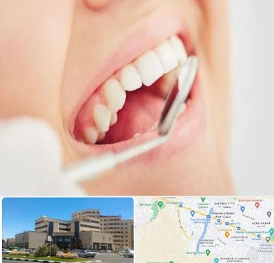 اصلاح طرح لبخند در صیاد شیرازی مشهد