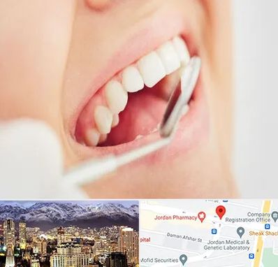 اصلاح طرح لبخند در جردن 